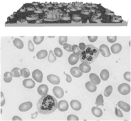 compares a gray scale image of a blood smear to the original colored image showing that darker colors are closer to black and lighter colors are closer to white