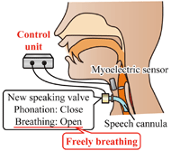 This figure shows our proposed compact speaking valve system with neck myoelectric control. The valve is attached to speech cannula installed to tracheostoma, and it is controlled by neck myoelectric signal. The myoelectric signal is detected by a myoelectric sensor attached to human neck. The detected signal is processed by control unit and converted to control signal of speaking valve. The speaking valve closes when phonation, and opens when breathing. This function leads the freely breathing.