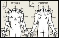 Picture of the upper extremity model used for kinematic data collection and processing. On left side there is the anterior view of the upper extremity model and on right side the posterior view of the model. In this picture the marker set is represented by filled circles on  suprasternal notch, xiphoid process, spinous process at C7, Acromioclavicular joint , inferior angle of scapula,  trigonum spine, scapular spine, acromial angle, coracoid process, humerus, olecranon, radial and ulnar styloids, third and fifth metacarpals. In this picture Joint centers are represented by the open circles: wrist, elbow, glenohumral, acromioclavicular, sternoclavicular joint centers and the thorax center. Arrows indicate global coordinate system & segmental coordinate systems. 