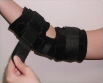 Figure 1 shows the elbow wrap modeled on a possible patient. The elbow wrap, manufactured by Benik, is made entirely of Velcro  sensitive neoprene and consists of two hinge pockets on either side of the arm with an aluminum 135  flexion/extension restraint.  The elbow brace is 9" in length and wraps around the arm at the elbow joint, leaving the elbow exposed.   The fit of the brace is adjusted with Velcro tabs and can be further tightened with removable Velcro  straps that secure onto the brace with Velcro and double-back through a D-ring.  