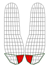 An outline of the instrumented insert is shown with divisions indicating individual sensors.  An area of approximately three sensors localizing the Hallux are highlighted.