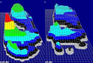 Left foot pressure distributions are shown for one subject.  Pressures are higher around the hallux during push off while wearing the AFO than without the AFO.