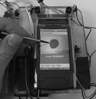 Figure show an image of a user interacting with the hand-held device for the purpose of correcting the border. Image is from the top side of the device. The user is holding a stylus which he is using to push the proposed border into place. The border is a series of connected green dots. The area of the wound is also shown in the bottom of the screen on the hand-held. 