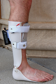 This image shows the completed prototype on the user.  This demonstrates that the AFO and electrode flap fits snugly on the patient’s leg and foot. The FES control unit is attached to the back of the AFO and the amount of free wires is limited.  The sensor and wire within the AFO are not visible when the device is in use. 