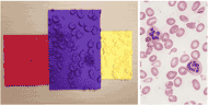 Blood smear tactile plates produced at three different scales from the image on the right. One of the tactile plates is an enlargement of part of the image with only one WBC visible.