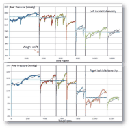 Curves showing changes of interface pressure underneath the left and right ischial tuberosities of one subject during experiment. The graphs shows the time of weight shift. 