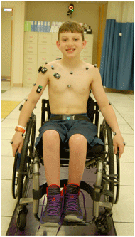 A frontal view of a young boy sitting in his wheelchair in the middle of the testing space with the reflective markers required by the upper extremity marker model adhered to his skin.  These markers are placed in the following locations, bilaterally: third and fifth metacarpals, ulnar and radial styloids, lateral humerus, coracoid process, acromion, suprasternal notch and xiphoid process, markers not visible are those on the olecranon, trigonum spinae, inferior angle, acromial angle, scapular spine and the spinal process C7. 
