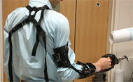 Picture of the donned body-powered bypass prosthesis, showing the harness’s position around the opposite shoulder and connection to the control cable allowing controlled opening and closing of the terminal device. Picture of the donned body-powered bypass prosthesis, showing the harness’s position around the opposite shoulder and connection to the control cable allowing controlled opening and closing of the terminal device. 