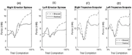 The image depicts four graphs measuring the force in the trapezius and erector spinae muscle during the completion of the block transport. 

Image A measures the right erector spinae muscle. Braced conditions began around 6 mN, fell to 4 mN and rose to 12 mN. Normal conditions began at 4 mN before decreasing to 3 mN and sharply rising to approximately 8 mN and leveling out.

Image B measures the left erector spinae muscle. Braced conditions began around 5 mN, and slowly rose to 8 mN. Normal conditions began around 3 mN before sharply increasing to 6 mN and leveling out around 5 mN.

Image C measures the muscle between the right trapezius and scapular nodes. Braced conditions began around 10 mN, rose to 13 mN, then drooped to 4 mN before rising to 18 mN and leveled off. Normal conditions followed a similar pattern. Normal began around 8 mN, rose to 10 mN, then drooped to 4 mN before rising to 14 mN and falling to 13 mN to level out. At time of pick up, both conditions slightly increased force.

Image D measures the muscle between the left trapezius and scapular nodes. Braced conditions began around 10 mN, rose to 13 mN, then drooped to 6 mN before rising to 17 mN and leveled off. Normal conditions followed a similar pattern. Normal began around 8 mN, rose to 10 mN, then dropped to 6 mN before rising to 14 mN and falling to 12 mN to level out. At time of pick up, both conditions slightly increased force.