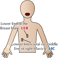 A schematic diagram of the measurement points for the myoelectric signal when the diaphragm motion. One part is the “lower end of the breast bone” and the other is the “lowest intercostal on middle line of right clavicle”.  