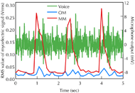 A line graph of the “time-series plot of the RMS value of the myoelectric signals and the output of the microphone in the tongue motion”. There are 3 polygonal lines in the graph: the amplitude of the voice, the RMS value of the omohyoid muscle (OM) and at the mylohyoid muscle (MM). The value of the MM is larger than the OM.  