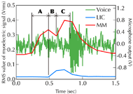 A line graph of the “time-series plot of the RMS value of the myoelectric signals and the output of the microphone in the tongue motion”. There are 3 polygonal lines in the graph: the amplitude of the voice, the RMS value of the that measured at the lower end of the breast bone (LEB) and at the mylohyoid muscle (MM). Additionally, the time difference between the MM to the LEB, the LEB to the MM, and the MM to the voice are shown as A, B and C in this figure.  