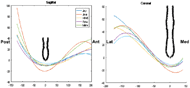 On the left, a generic ischium is plotted with 5 contours representing the sagittal view, and on the right is the coronal view. Four of the contours, representing Jay, HR45, Roho and Matrx are very similar near the ischium with some differences as you move anterior, posterior and lateral. The Java contour is more inferior to the ischium than the others. 