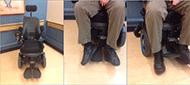 Three photos portraying from left to right, (1) a power wheelchair with a center mounted footplate. The center mounted footplate has two pieces, one for each foot. (2) This photo shows the legs and feet of a person sitting on the same power wheelchair as in (1), the right leg is externally rotated so that the knee and toes of the foot are pointing to the right and the right foot is sitting on its outer edge on the foot plate, the left foot extends beyond the end of the footplate; (3) This is a side angled view of the same person's right leg and foot with the right leg dangling off the footplate and resting on the floor in front of the caster and drive wheel. 