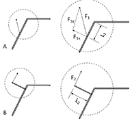 The first part of the figure represents the lever arm created by the user without using the new mechanism. Only a part of the force applied on the orthosis is used to create a rotation around the knee. The second part of the figure is the lever arm created by the user using the new mechanism. Almost all the force applied on the mechanism is used to create a rotation around the knee.