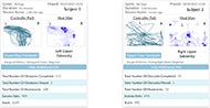 Figure displays two examples of the data screens produced by the teletherapy system. Data screen for Subject 1 is on the left. A similar screen is shown on the right for Subject 2. Each of the data screens follows the same template. The differences between the two screens are the actual maps and data elements. The screen on the left, corresponding to the data for Subject 1, who performed therapy on their Left Upper Extremity. The two salient features in this screen are the two maps shown within. The map on the left corresponds to the controller path, which represents the trace of where the left arm was within the reachable therapeutic workspace. In this case, Subject 1 was able to reach a large part of the left side of the map, corresponding to their left side of the body. However, the right-hand side of the map is mostly empty, implying that the Subject was not able to reach their right-hand side easily. To the right, there is a heat map, which corresponds to the number of times Subject 1 traversed various regions of the reachable therapeutic workspace. Blocks inside the heat map are shaded a darker blue corresponding to regions of the workspace which were traversed more often. Regions shaded lighter were not traversed as frequently. Regions which were not traversed at all are white. The screen to the right corresponds to the data for Subject 2. The map on the controller map graph is spread out across most of the workspace, except for the upper right quadrant, corresponding to the right-hand side of the body. The corresponding heat map has a few dark blue blocks towards the center of the map plus a few scattered ones to the right and one on the upper left.