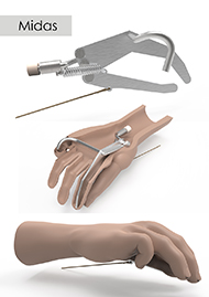 'In the upper left corner is the name of our product: MIDAS

Underneath are three 3D renders of our product. From top to bottom: the internal structure, a sectional view of the prosthesis and the full prosthesis.

The internal structure is shown in lateral view, and enables the reader to understand the working principle of the prothesis/internal device. The mechanical elements represent a hand where the index and the thumb could make a pinching motion.

In the sectional view underneath, the structure is placed inside of the lower part of the shell: The hook is set down in the pinkie's place and the thumb and the index make a pinching motion.

The upper shell will then be positioned on the structure and locked into the lower aesthetic hand. The last image shows the fully assembled prosthesis. It depicts a hand where the pinkie is bent, and where the ring finger and the middle finger are straight. The thumb and index are in a pinching motion. We also see the control cable coming out of the back of the thumb.'