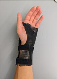 A hand with a custom-formed wrist brace made from 3D-printed PLA material is shown.