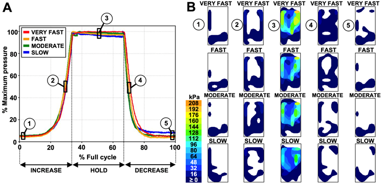 Part A) shows four curves, each of the normalized maximum pressure plotted against the percent of the full cycle, at four different volume change rates: VERY FAST, FAST, MODERATE and SLOW. The full cycle includes the volume increase, hold, and decrease periods. Part B) shows a heat map of pressure distributions taken when volume change was -2.5% and 0% during the increase period, +2.5% during the hold period, and 0% and -2.5% during the decrease period. Pressures range from 0-16 kPa at -2.5% and increase to a maximum of 208 kPa at some local areas when volume is +2.5%.