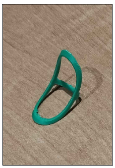 3D model of an initial splint design