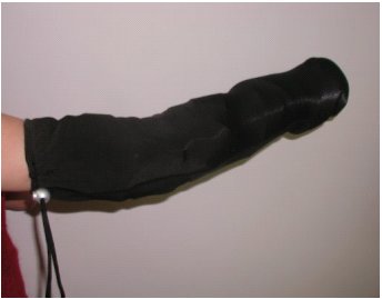 Figure 3 shows the completely assembled device, modeled on a potential patient. The device is completely enclosed with a Lycra  or knit sleeve and is secured at the upper arm with a drawstring cord. 