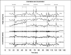 This graph shows six time-varying signals for triaxial orientation (roll, pitch, and yaw) and acceleration (up/down, A/P, side/side). Balance instabilities are marked. 