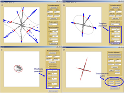 Photo1 includes four sub photoes. Photo A shows the result of an astroid template where speed and direction signals were constrained inside the template, outside points are identified, and boundary points are cacluated. Photo B shows the elliptical template after resize and rotation. Photo C shows the elliptical dead zone including all the tremor signals, and Photo D shows the bias axis and tranformation matrix. 