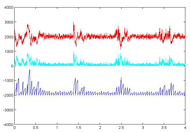 The figure shows three time domain signals, the EMG signal which is made up of individual motor neuron action potentials, a rectified signal which looks similar to the EMG signal but all values are positive, and a signal representing the cumulative sum of the rectified signal reset to 0 every 50 samples.