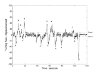 Graph plots the rate gyroscope output in degrees per second versus time while a subject walked a course in a hospital environment (see description of Figure 1).