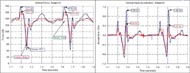 This figure is a plot of the data collected during a bump test, with the rigid and suspension chairs. The Figure shows two plots one for force and the other for acceleration data. It can be seen in the plots that the suspension chair creates reduced forces and accelerations in this test for the user. 