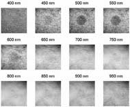 The best, cropped image for each filter is shown for a single subject. The erythema is most visible in the 450 – 600nm filtered images, and has varied visibility in other filters. 