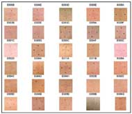 These 30, unfiltered color photographs show erythema on subjects with varying skin tones. These images have only been cropped and not processed. Erythema is clearly visible in some images. 