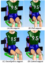 Figure 1 shows the backrest supporting the body in 4 configurations: no support, or none of the bladders inflated; full support, or all of the bladders inflated; the sacral/pelvic support inflated only; and the lateral thoracic supports inflated only.