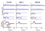 Figure 3 shows graphical representation of the EMG and kinematic data from a reaching activity. No support showed the highest EMG readings and longest amount of time for the reaching activity; sacral/pelvic support only showed the least, with a slight increase when thoracic support only was used.