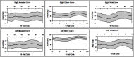 Joint motion curves for the 20 patients averaged in the study. The joint curves are viewed from the sagittal plane and have a 95% confidence interval band, positive: flexion, negative: extension.