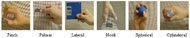 Image illustrates six grips. Pinch grip (the pad of the thumb and index finger are in apposition to pick up or pinch a small object, like a bead); Palmar grip (the pad of the thumb is against pads of index and middle fingers); Lateral grip (the pad of the thumb is in apposition to the lateral aspect of the index finger to manipulate a small object e.g.. turning a key in a lock); Hook grip (the distal interphalangeal joint and proximal interphalangeal joint are flexed with the thumb extended e.g., carrying a briefcase by the handle); Spherical grip (the tips of fingers and the thumb are flexed e.g. opening a doorknob); Cylindrical Grip (the entire palmar surface of the hand grasps around a cylindrical object, such as a coffee mug) 