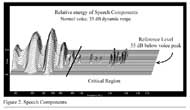 Figure 2. Speech Components. Shows a 3D spectragram of voice, revealing that low frequency components have highest amplitude while higher frequency components that are essential to intelligibility are 20dB to 30dB weaker.