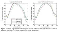 Normalized plots of percent path versus percent buttocks height show that Subject 15&rsquo;s transfer strategy is smooth and repeatable.  