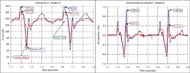This figure is a plot of the data collected during a bump test, with the rigid and suspension chairs. The Figure shows two plots one for force and the other for acceleration data. It can be seen in the plots that the suspension chair creates reduced forces and accelerations in this test for the user. 