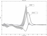 Displays the ankle power (Watts/kg) for the left side, with the control group shaded gray and the OI group plotted with the standard deviation band.