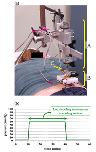 This figure (a) shows a subject lying prone with the customized test system applied to the sacrum skin.  Part A is for pressure control, part B is for temperature control and part C is LDF probe. (b) shows changes in pressure throughout the test, and local cooling is applied during the period of 60mmHg pressure. 
