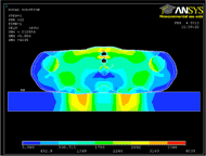 Figure 8 shows computational result of upper shoulder model. 