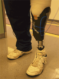 Figure 1. A photograph of the kinetic sensor attached to a subject's prosthesis. The kinetic sensor is a metal housing containing a force sensor. It is located directly below the subject's prosthesis socket. The image also shows the cable connecting the sensor with the belt pack. The pylon of the prosthesis is connected to the bottom of the kinetic sensor. 